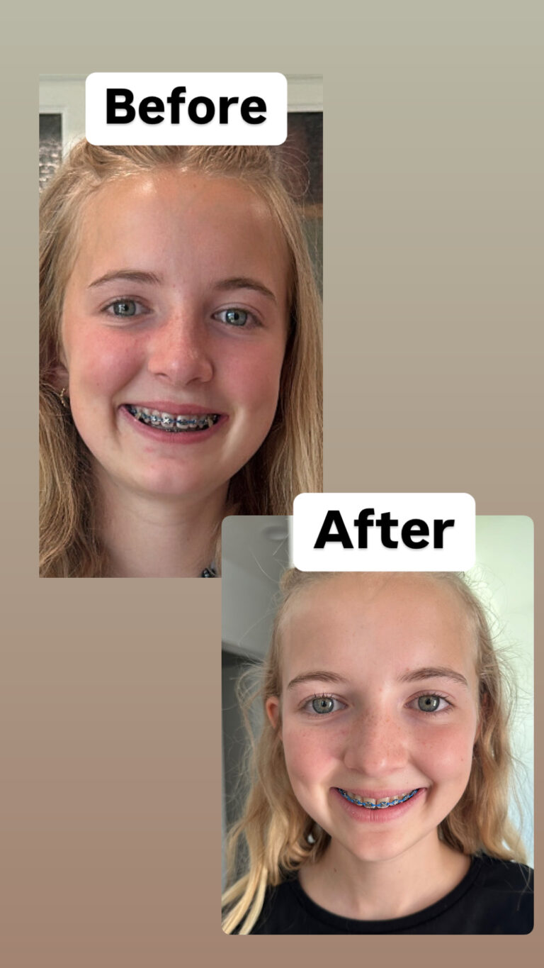 The Skincare Products My Teen and Tween Use